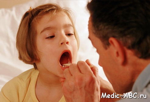 Чем лечить горло у ребенка 